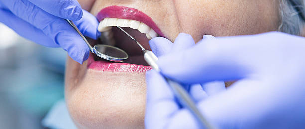 Best Knocked-Out Tooth (Avulsed Tooth) Treatment in Havelock, NC